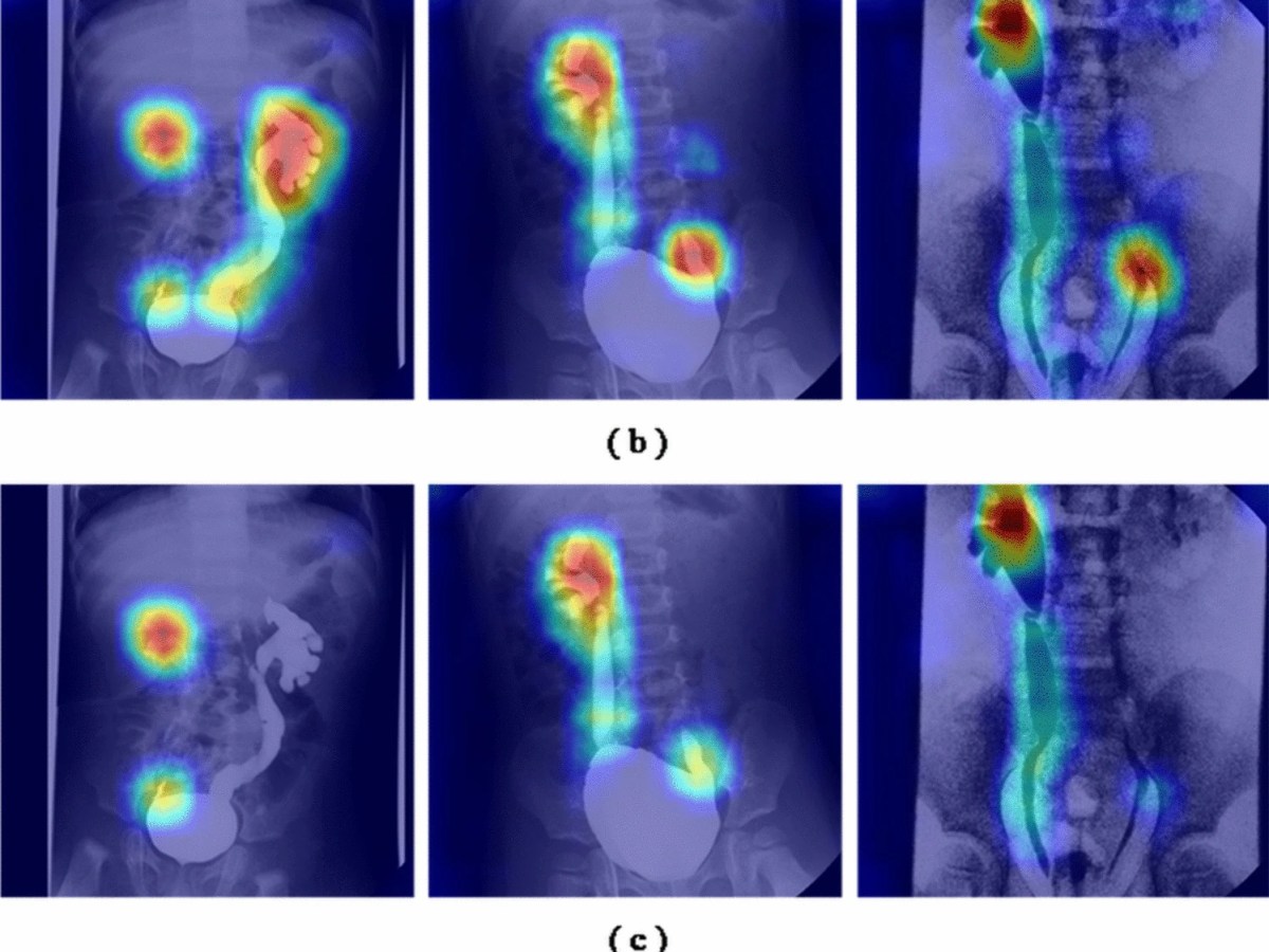 Chen et al.&nbsp;(2025)